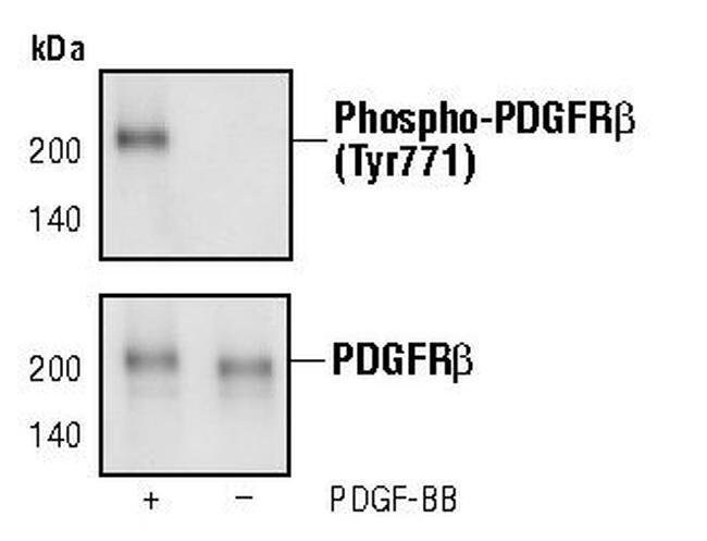 Antibody Phospho-PDGF Receptor beta (Tyr
