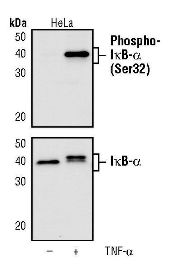 100UL PHOSPHO-I-KAPPA-B-ALPHA (SER32) .