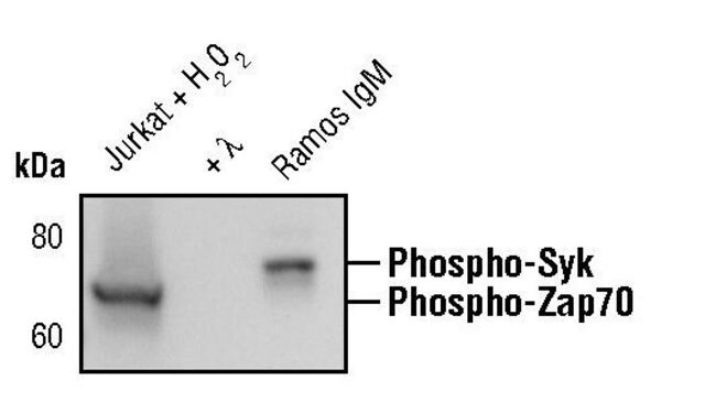 Antibody Phospho-Zap-70 (Tyr319)/Syk (Ty