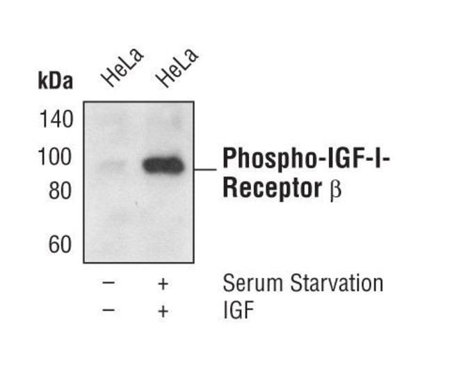 Antib. Phospho-IGF-I Recep. ß (Tyr1135/