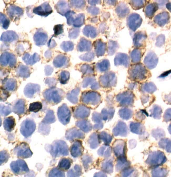 100UL PHOSPHO-M-CSF RECEPTOR (TYR723) .
