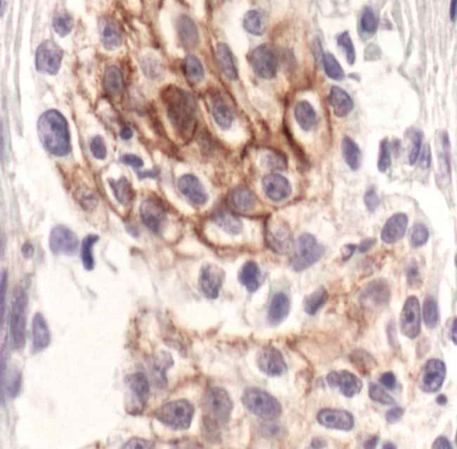 100UL PHOSPHO-HER3/ERBB3 (TYR1289) .