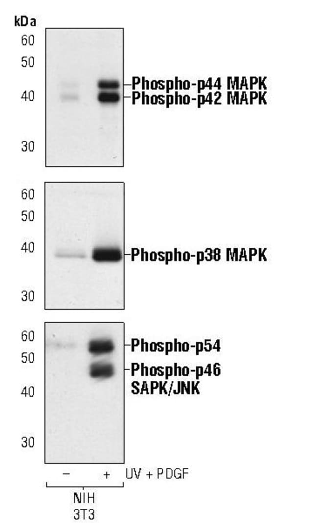 200UL PHOSPHO-SAPK/JNK (THR183/TYR185) .