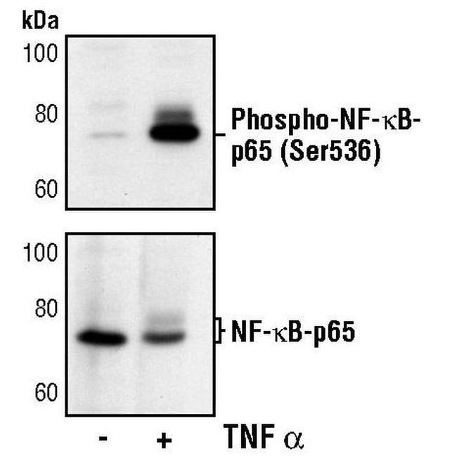 100UL PHOSPHO-NF-KAPPAB P65 (SER536) .