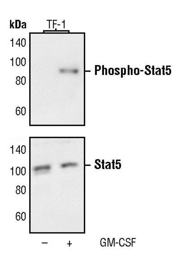 100UL PHOSPHO-STAT5 (TYR694) .