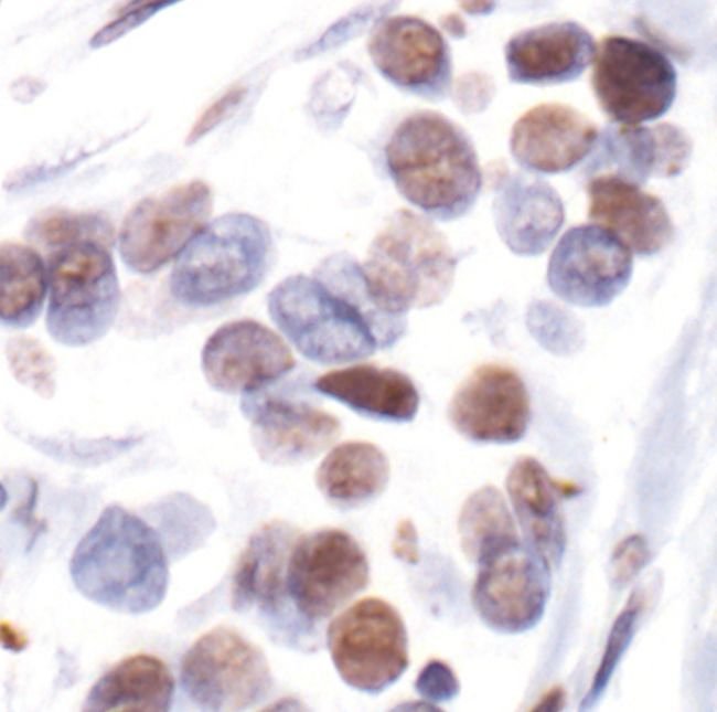 Antibody Phospho-Estrogen Receptor -alph