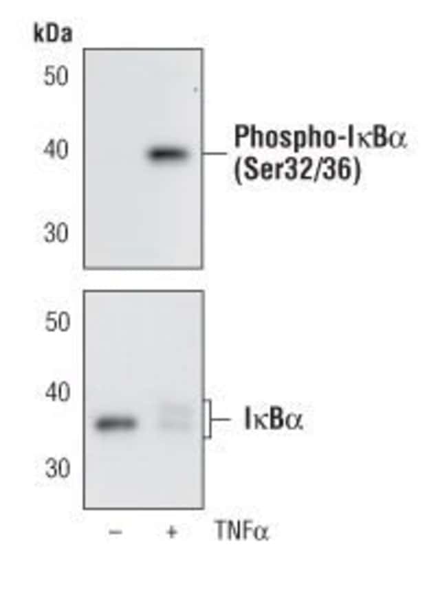 100UL PHOSPHO-I-KAPPA-B-ALPHA (SER32/36)