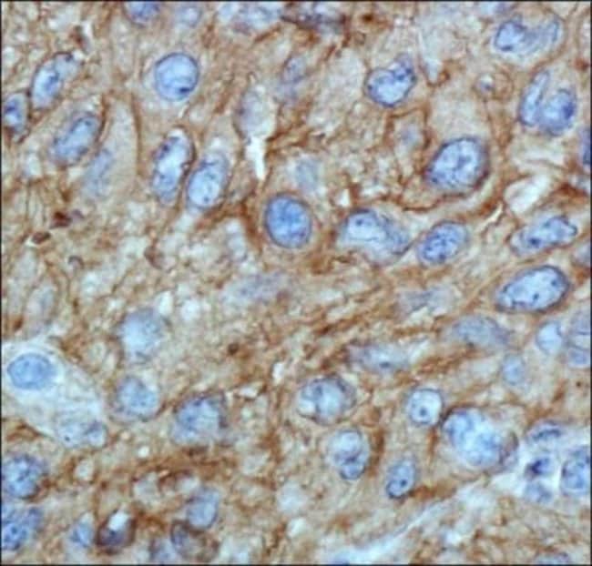 ABCA1 Monoclonal Antibody (HJ1), 100 µl