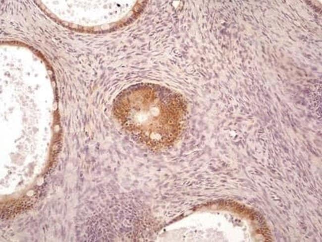 AGR 2 Monoclonal Antibody, 100 µg