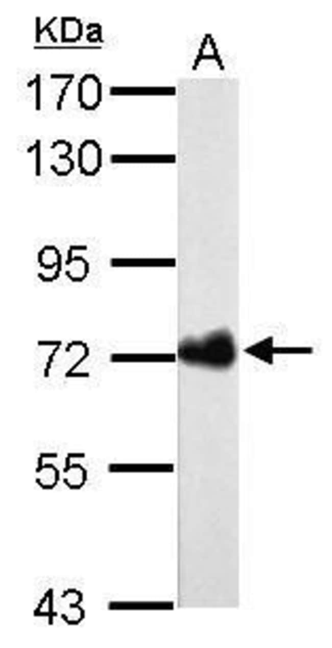 Anti-Urease B