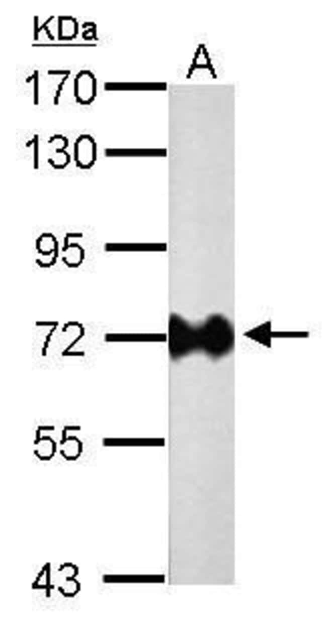Anti-Urease B