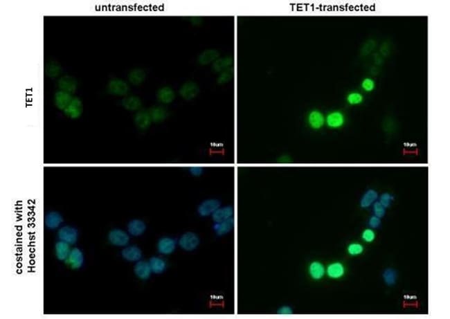 Anti-TET1