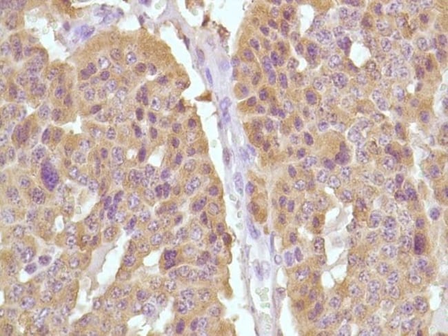 Anti-Calcitonin