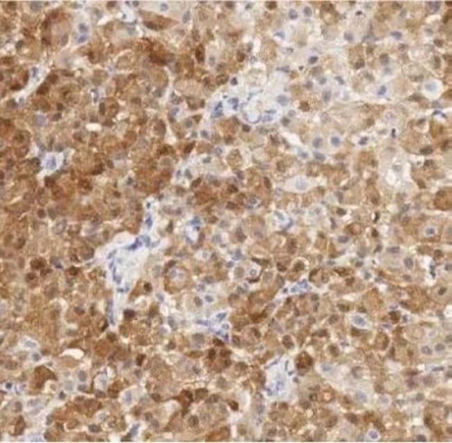 Anti-Calretinin