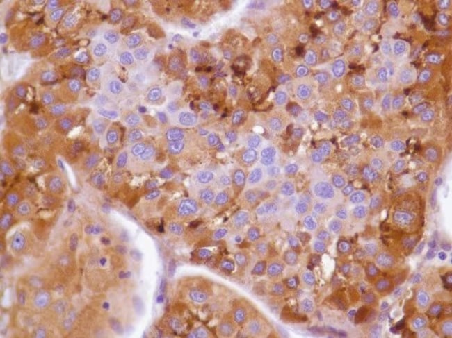 Anti-Glypican-3