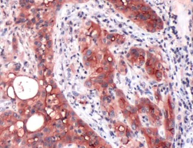 Anti-Mesothelin