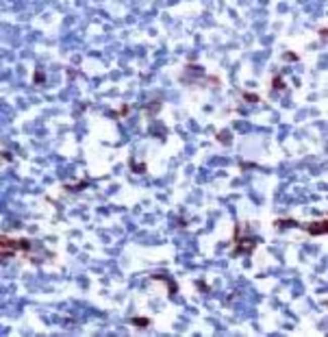 Anti-Myeloperoxidase