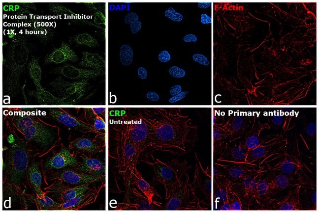 100UL CRP Monoclonal Antibody (1G1) host