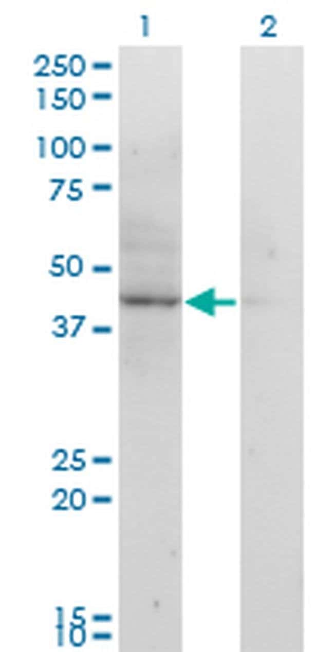 100UG ACAT2 ANTIBODY (4A5)