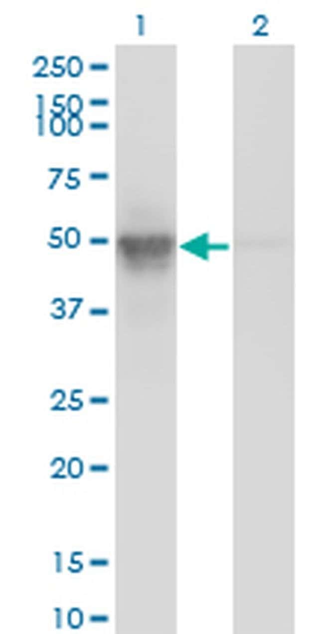 100UG ACTL6A ANTIBODY (3C4)