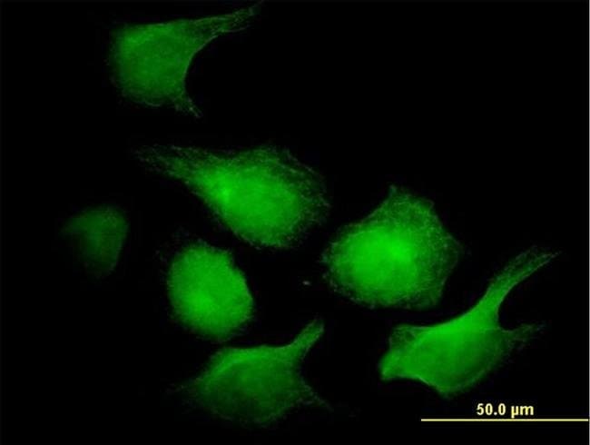 100UG AK1 ANTIBODY (3G8-1B11)