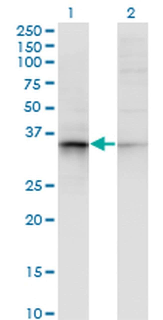100UG AKR7A2 ANTIBODY (2H3)