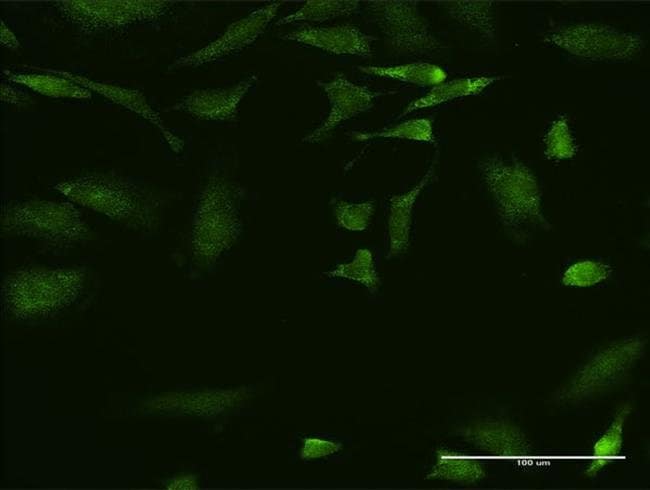 100UG AIMP1 ANTIBODY (1C11)