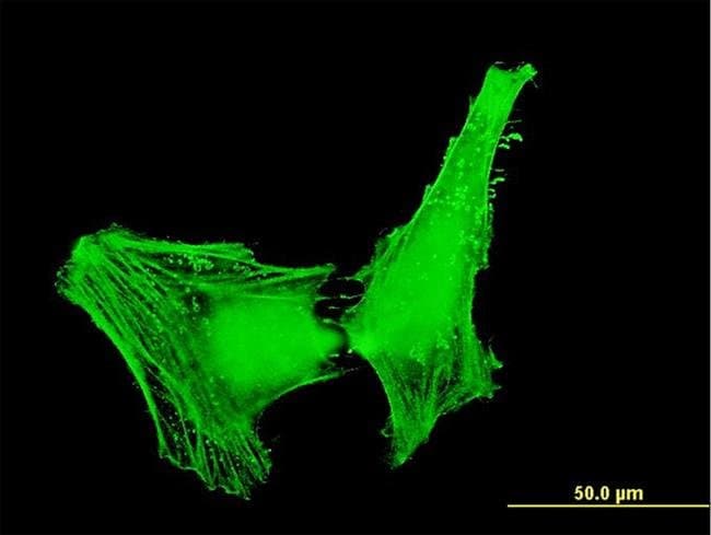 100UG ACTR1B ANTIBODY (4E10)