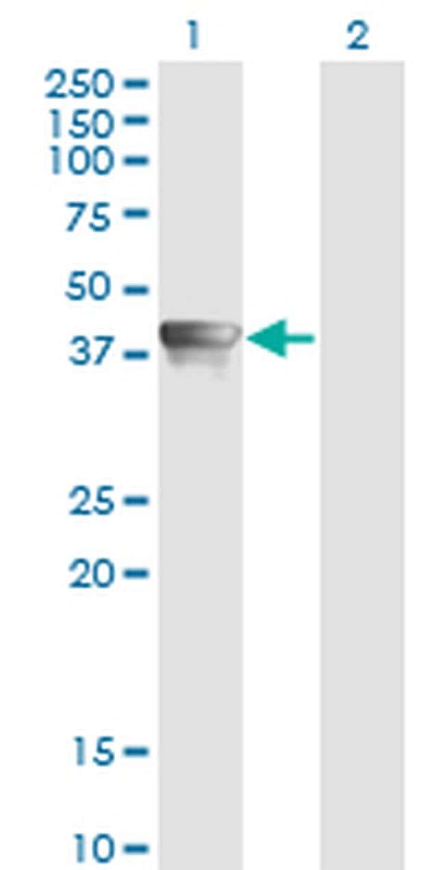 100UG AHSA1 ANTIBODY (4F3-B6)