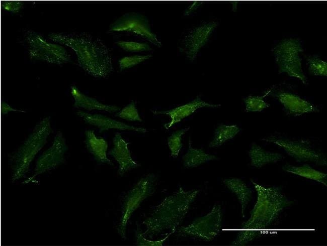 100UG ABCB9 ANTIBODY (4F4)
