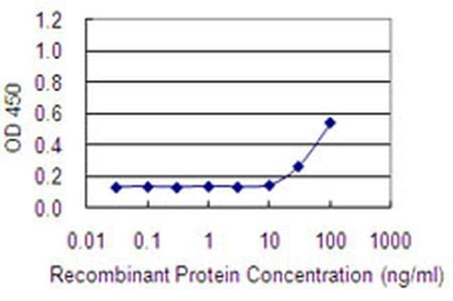 100UG ADCK1 ANTIBODY (1E8)