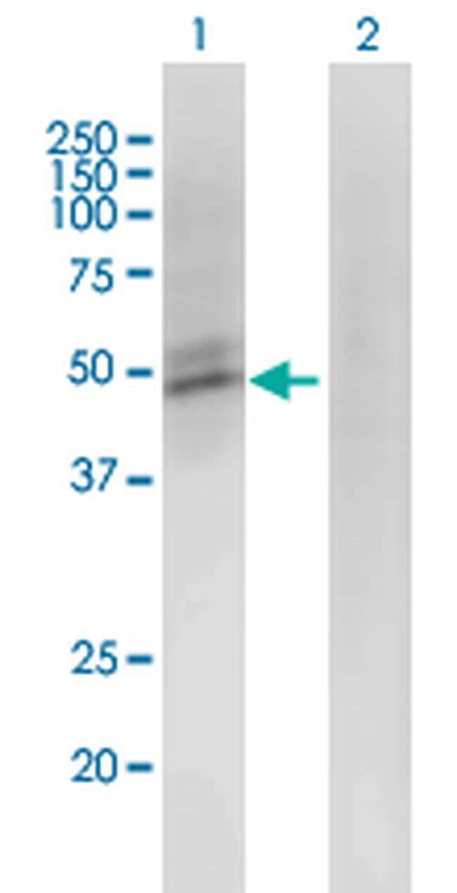 100UG ACMSD ANTIBODY (3A9)