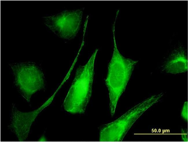 100UG AK9 ANTIBODY (1H8)