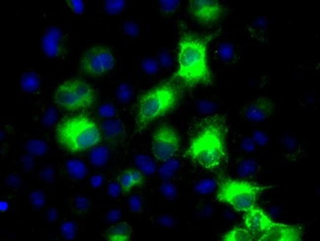 100 UL CYP2E1 Monoclonal Antibody (OTI5B