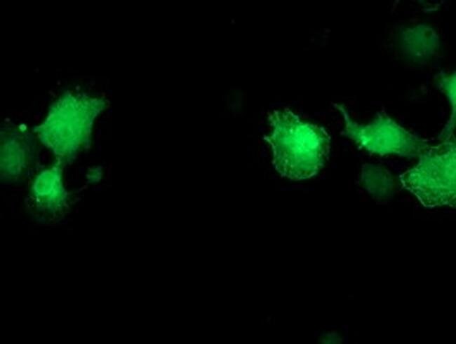 100 UL Primary Antibodies