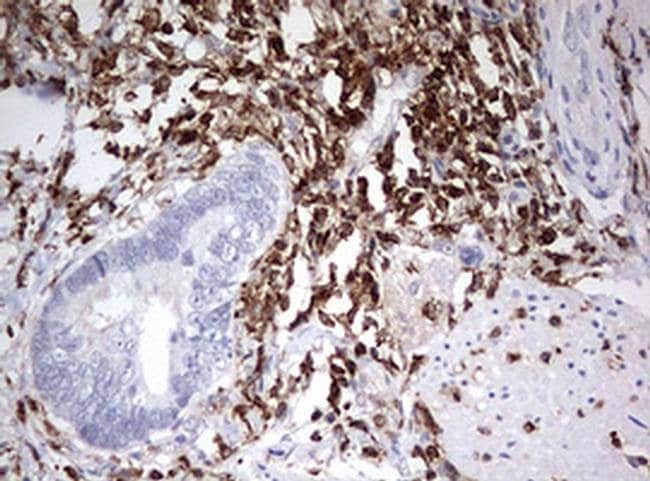 100 ML DOCK2 Monoclonal Antibody (OTI7G2