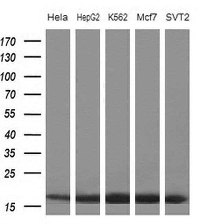 100 UL eIF1AY Monoclonal Antibody