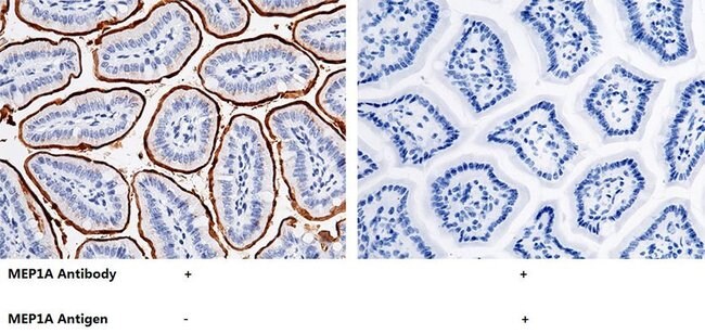 100UL MEP1A ANTIBODY 100 UL