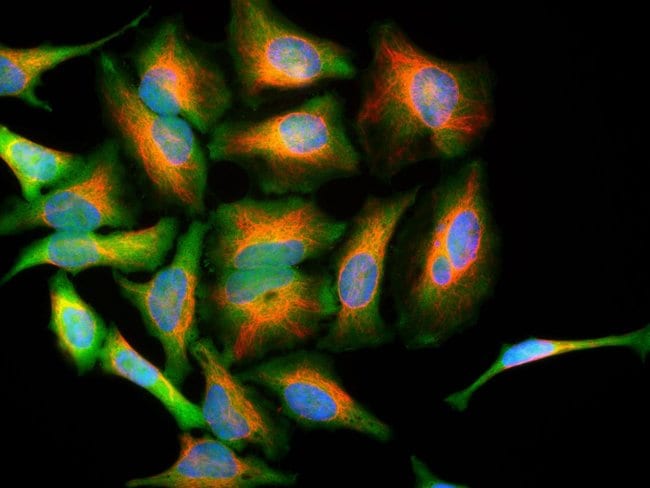 100UL DJ-1 ANTIBODY 100 ul