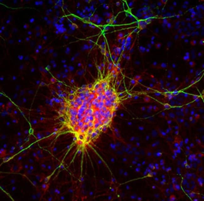 100UL DOUBLECORTIN ANTIBODY 100 ul
