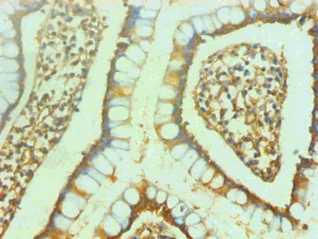 100UG NSE ANTIBODY 100 ug