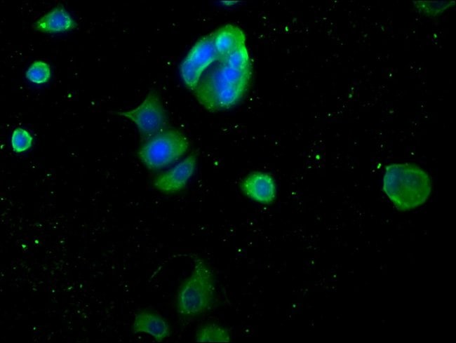 100UG MYOGLOBIN ANTIBODY 100 ug