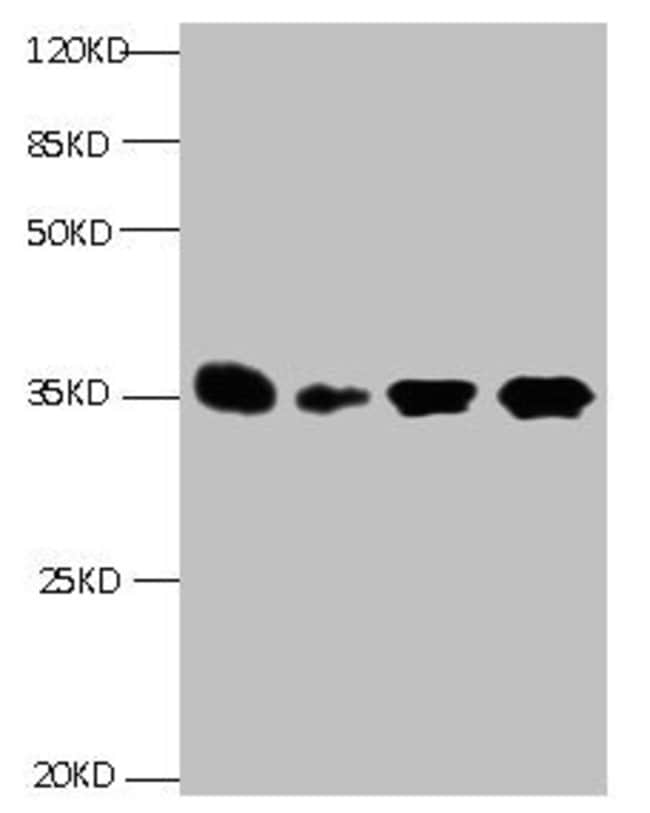 100UG IGFBP1 ANTIBODY 100 ug