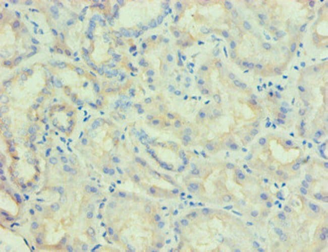 100UG PLA2G7 ANTIBODY 100 ug