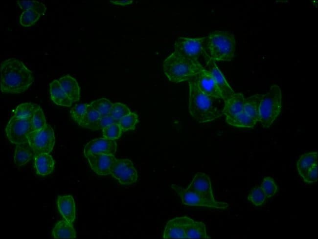 100UL ACTIN ANTIBODY 100 ul