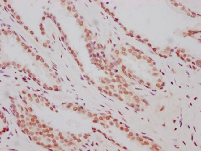 100UL HIF-1 BETA ANTIBODY 100 ul