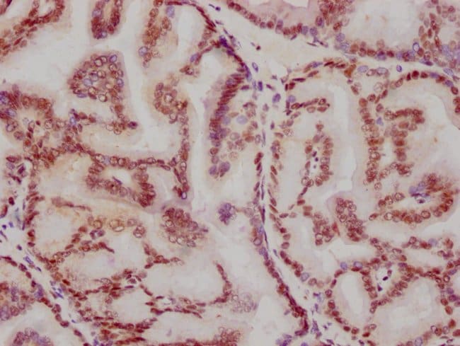 100UL ATF2 ANTIBODY 100 ul