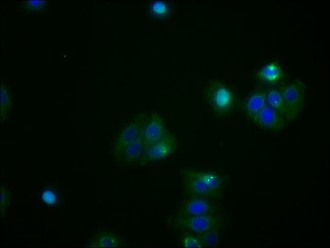 100UL ATF4 ANTIBODY 100 ul