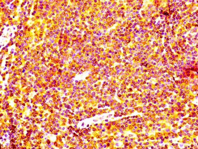 100UL BCL-2 ANTIBODY 100 ul