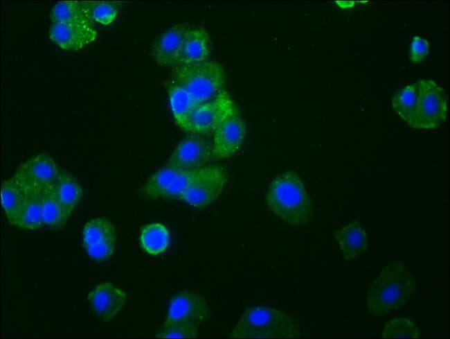 100UL CCR9 ANTIBODY 100 ul